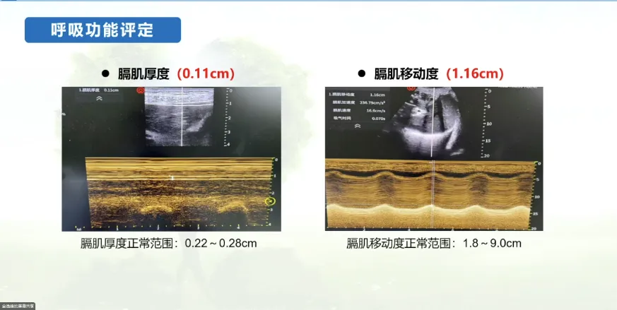 微信圖片_20250815102941_34